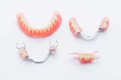 The image displays a set of clear braces with pinkish-red toothpaste smeared on them, arranged against a white background.