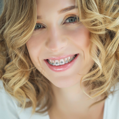 The image features a woman smiling at the camera with braces, wearing a light-colored top and her hair styled in loose waves.
