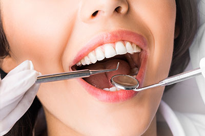 The image shows a woman with her mouth open wide, receiving dental treatment, with a dental practitioner using a drill on her tooth, and she appears to be smiling or laughing while wearing white gloves and holding a dental mirror.