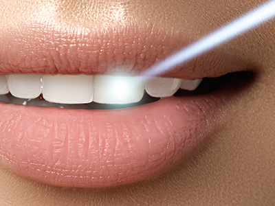 The image features a close-up view of a woman s lips with a focus on her teeth, which are being highlighted by a blue light, possibly from a device she is using, against a blurred background.